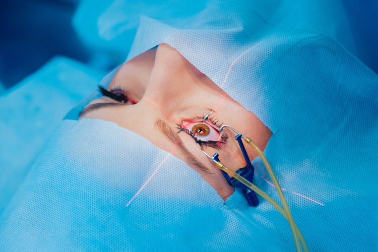 Persiapan Sebelum Lasik Mata, Perawatan Setelahnya, dan Biaya Lasik Mata