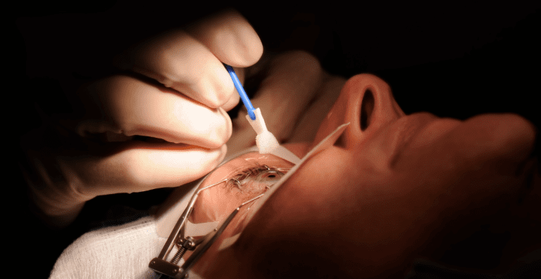 Sudah Operasi LASIK, Apakah Tetap Butuh Kacamata?