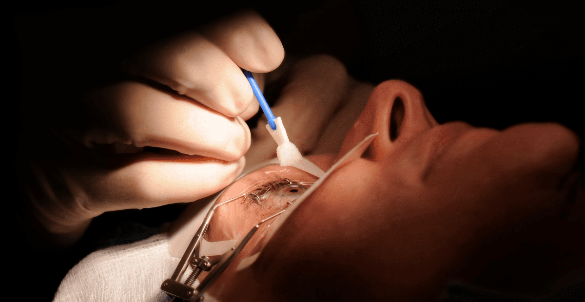 kacamata setelah operasi lasik