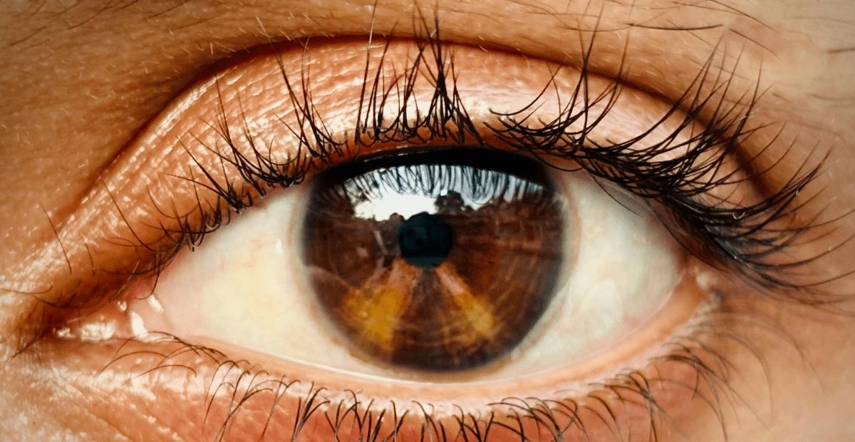 ablasio-retina