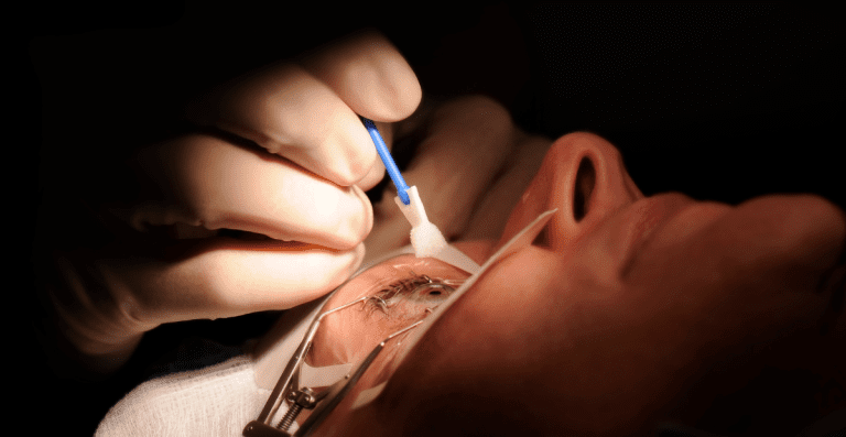ReLEx SMILE vs LASIK, Apa Bedanya dan Mana yang Lebih Efektif?