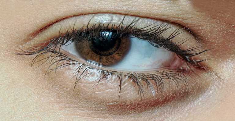 Penyebab Ablasi Retina dan Gejalanya, Kapan Harus ke Dokter?