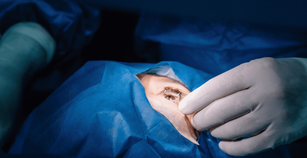 fotokoagulasi-laser-dan-fungsinya-untuk-mata