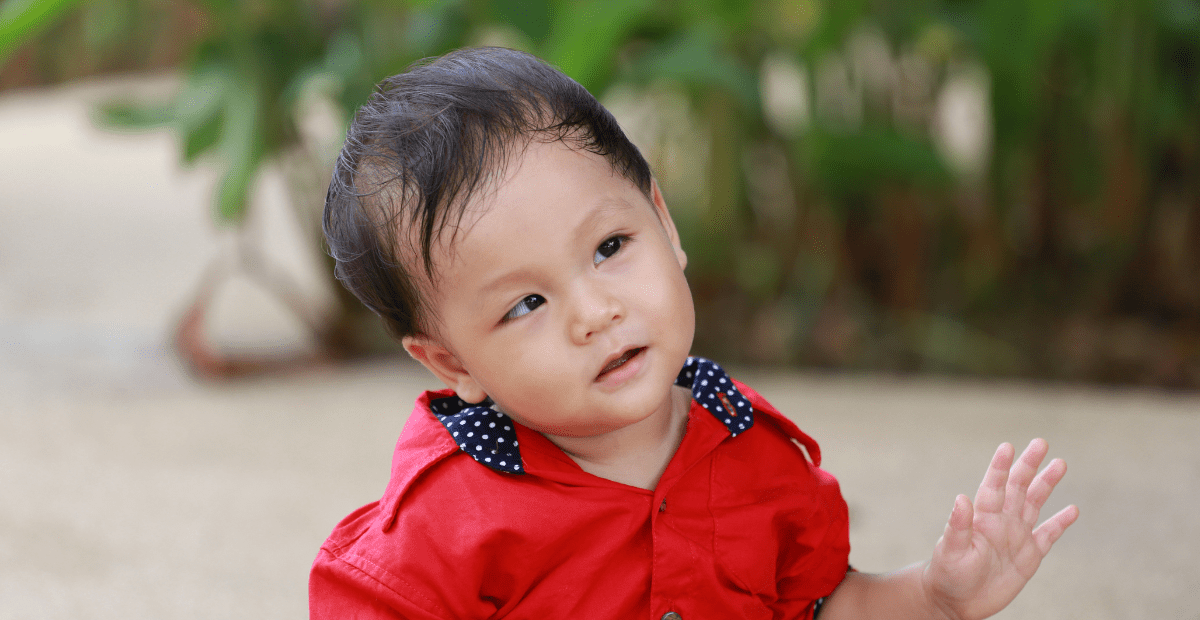 pseudo-strabismus