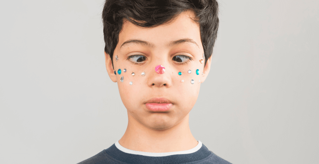 perbedaan-strabismus-dengan-mata-malas-ambliopia
