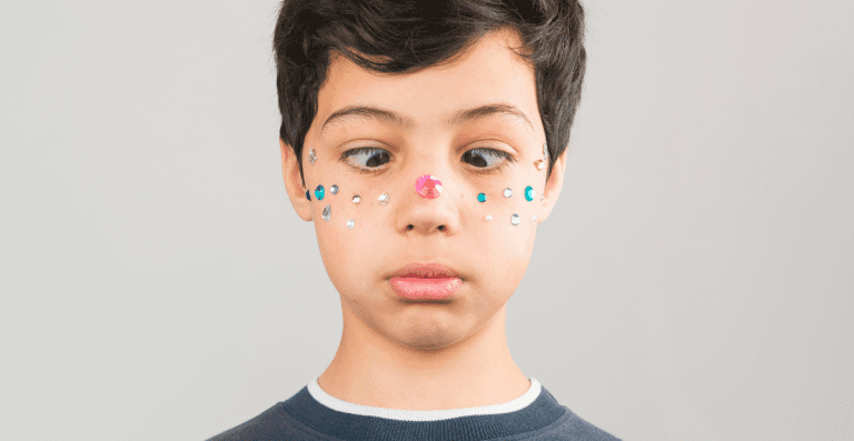 Perbedaan Mata Juling (Strabismus) dan Mata Malas (Ambliopia)