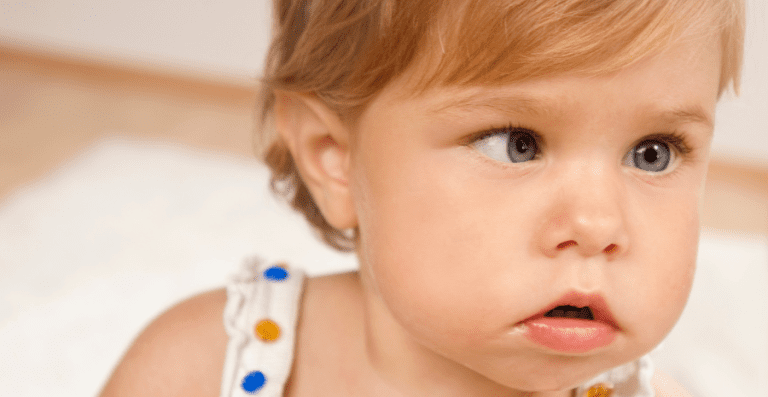 Waspada Mata Juling Pada Bayi! Kapan Perlu Diperiksa?