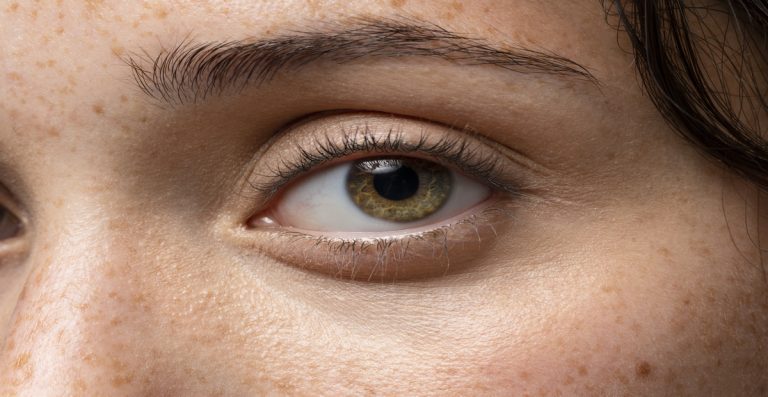 Operasi Strabismus: Prosedur, Keamanan & Hasilnya
