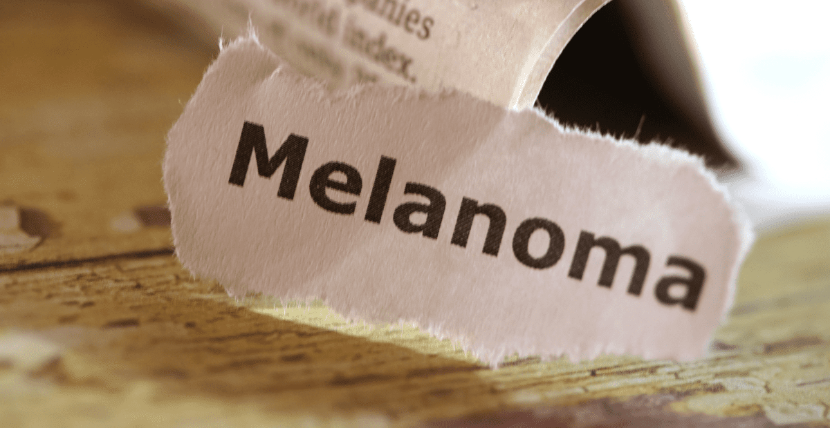 faktor-risiko-kanker-mata-melanoma